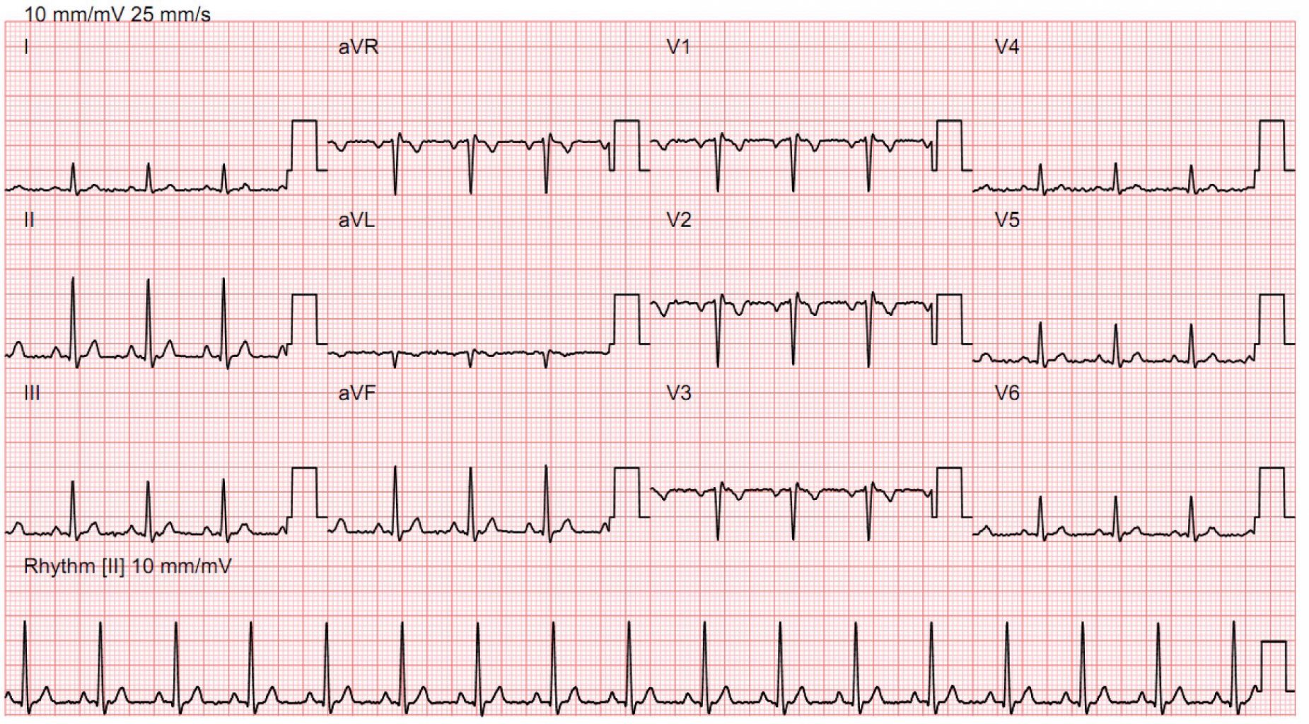 Electrocardiogram (ECG) – Bayside Medical Group